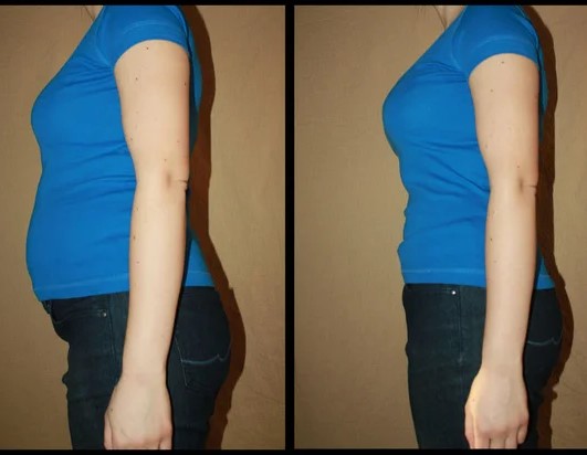 Bloat Buster